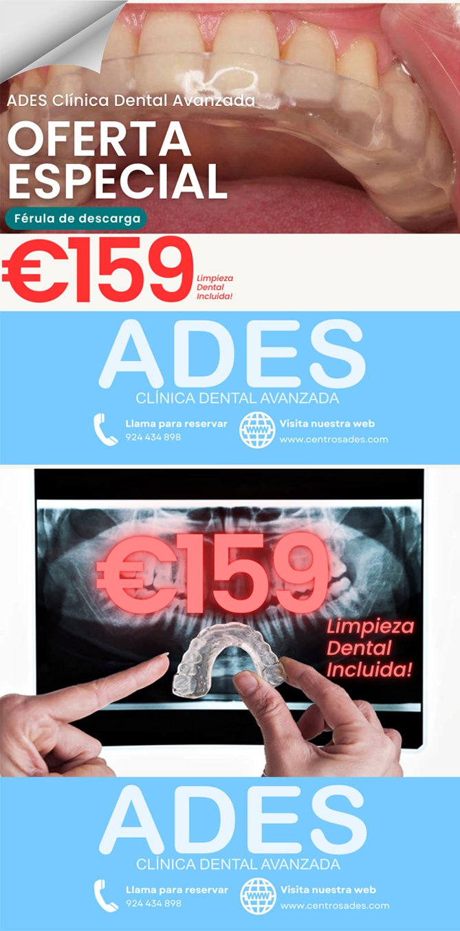 inter dental