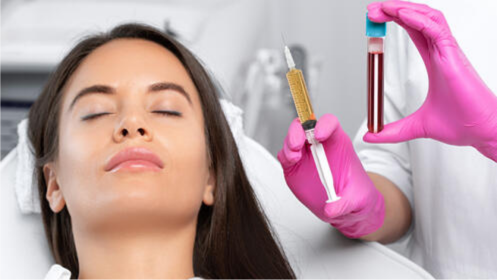 Bioestimulación facial o capilar con plasma rico en  plaquetas o