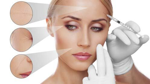 MESOTERAPIA FACIAL MÉDICA